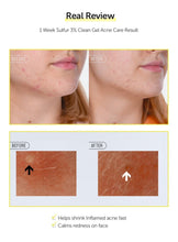 Load image into Gallery viewer, By Wishtrend - Sulfur 3% Clean Gel 30gr
